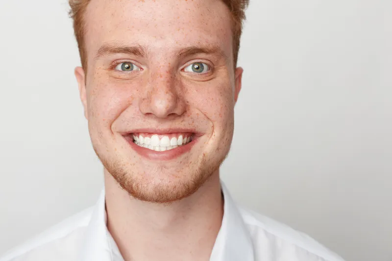 Close-up portrait of a smiling young man with red hair and freckles wearing a white shirt. Bright studio lighting highlights his clear skin and friendly expression on a plain background.