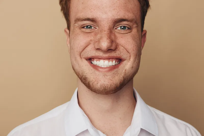 Smiling young man with freckles and blue eyes wearing white shirt looks at camera on beige background. Concept of happiness, confidence, and natural beauty portrait.