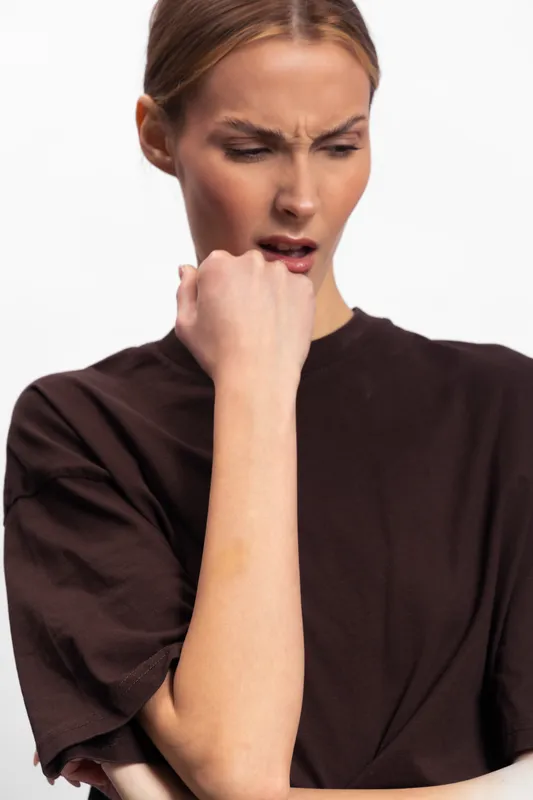 Young woman in dark shirt looks confused at skin irritation on her forearm. Close-up of irritated skin with redness and rash. Concept for skin allergy, irritation, and health concern.