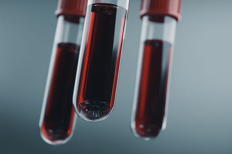 Close-up of blood-filled test tubes suspended in a laboratory setting, highlighting deep red liquid samples used for medical diagnostics, research, and clinical analysis.